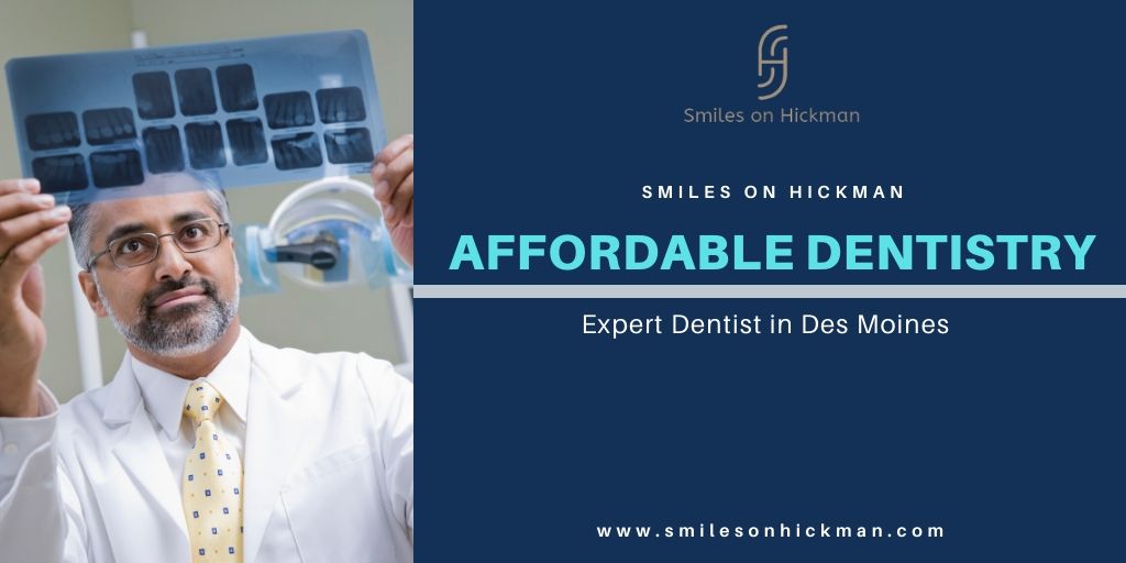 Affordable Dentistry in Des Moines