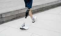 Walk on Your New Prosthetic Leg