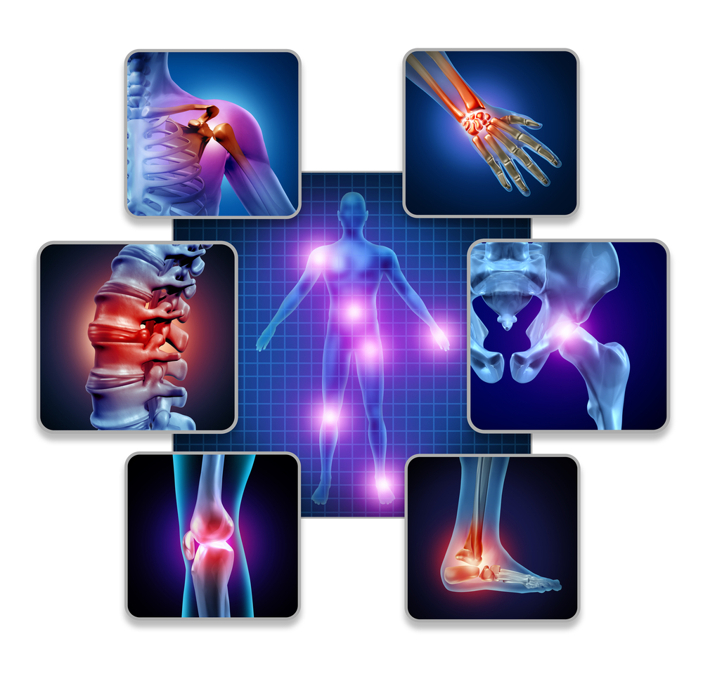 joint pain images